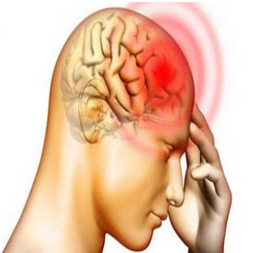 سێ جۆر جەڵتەی مێشک و لێکەوتەکانی