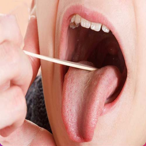نەشتەرگەری ئاڵوو
