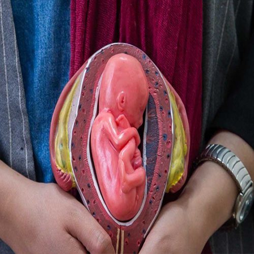 نابەرەوەری و رێگای چارەسەری