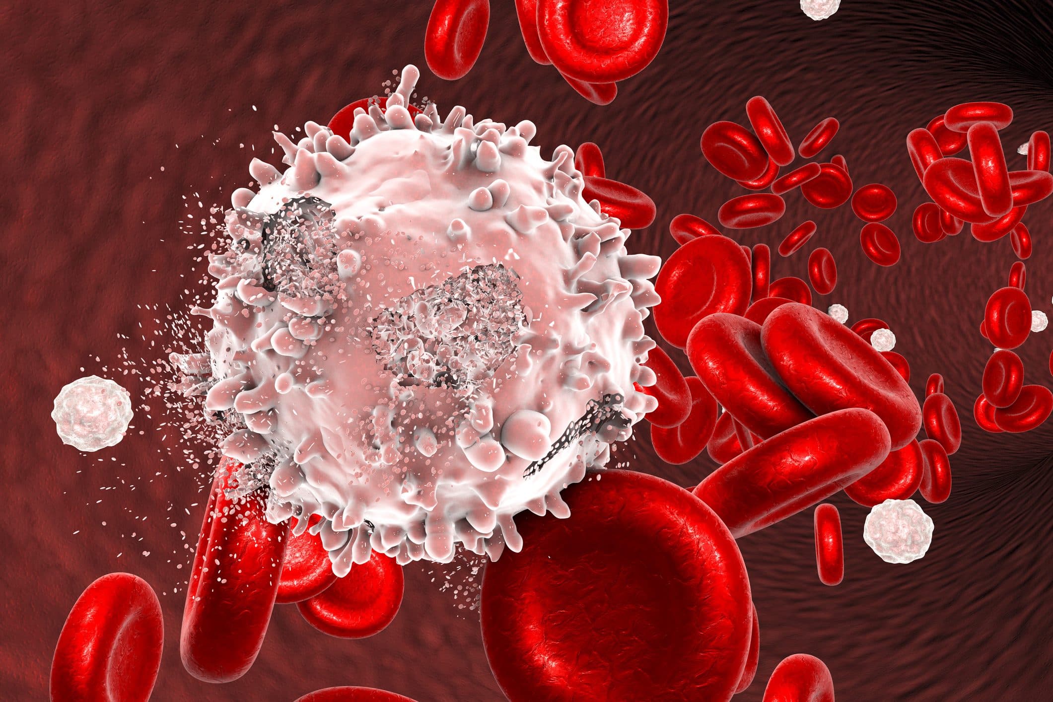 leukemia