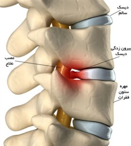دیسک